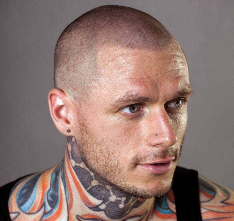 Scalp Micropigmentation: Hair Tattoo Benefits, Before & After